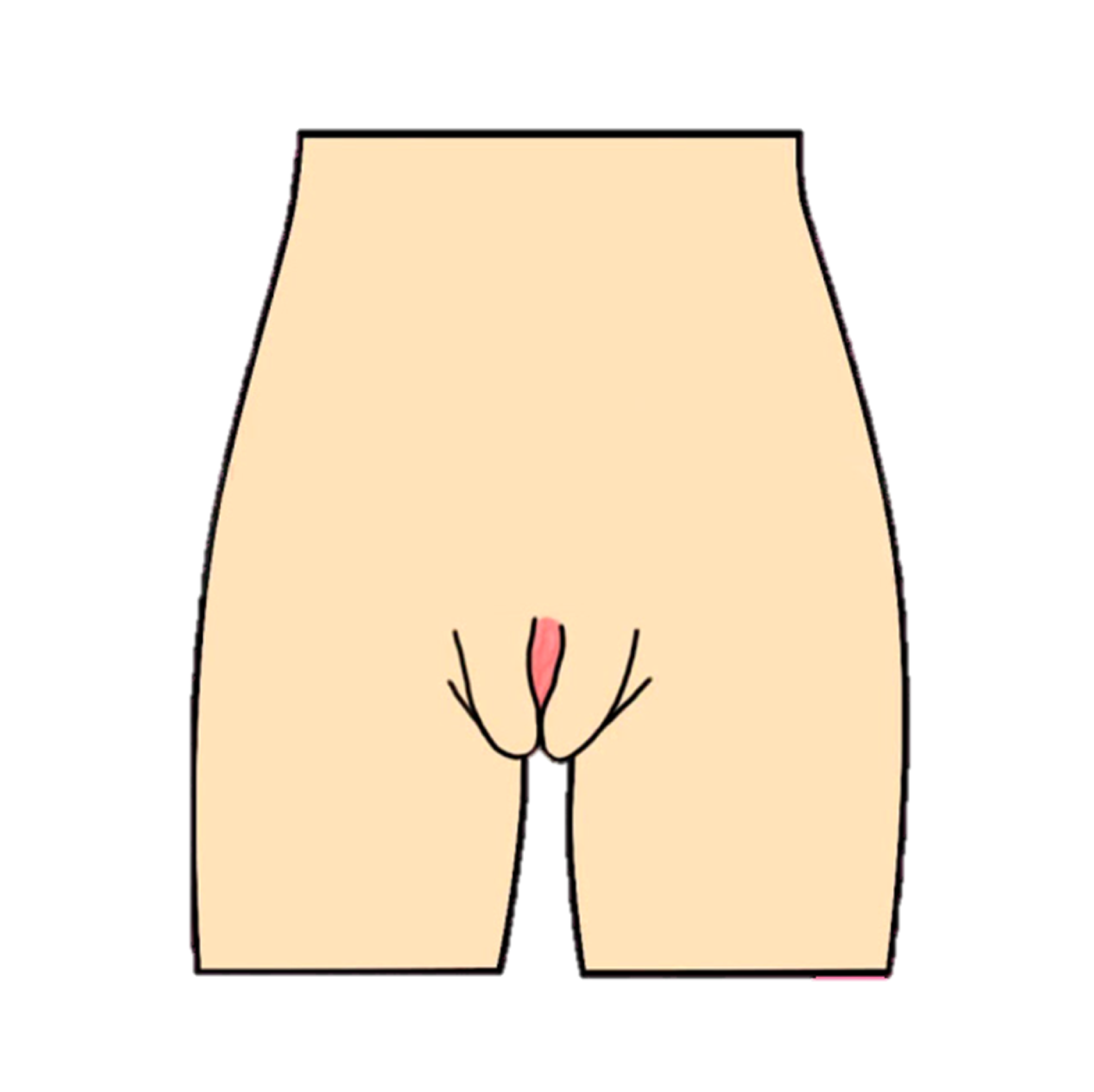 vulva tipo herradura